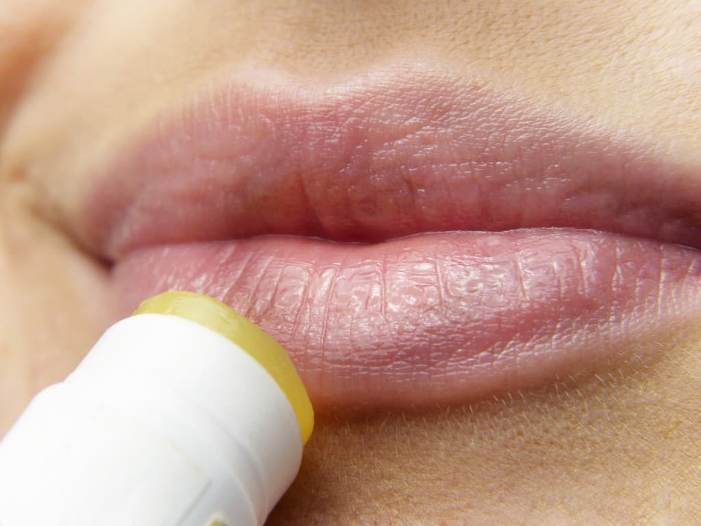 Prevenção do herpes labial é possível