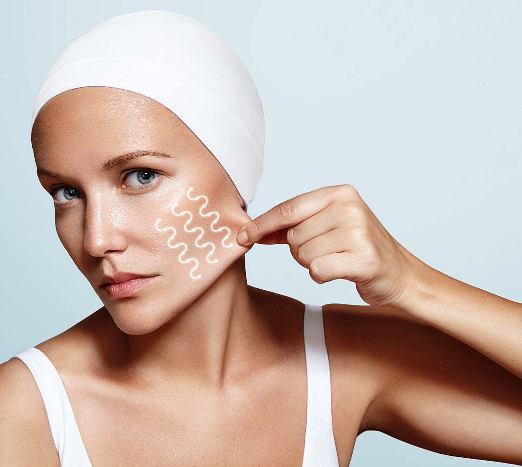 Bioestimuladores de colágeno: conheça o tratamento da vez para tratar a flacidez facial e corporal