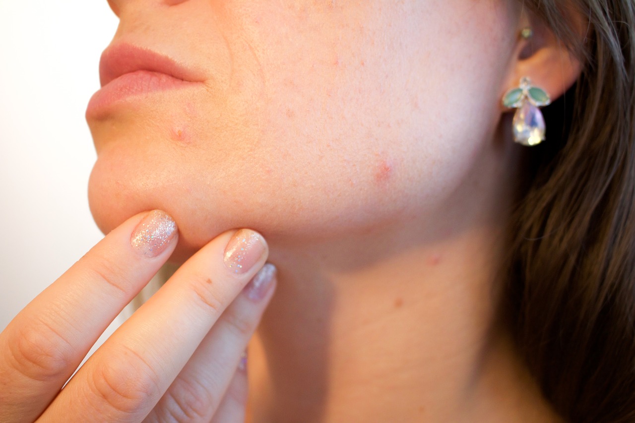 Vitanol, Vitacid, Ácido Retinóico, Tretinoína, Retinol