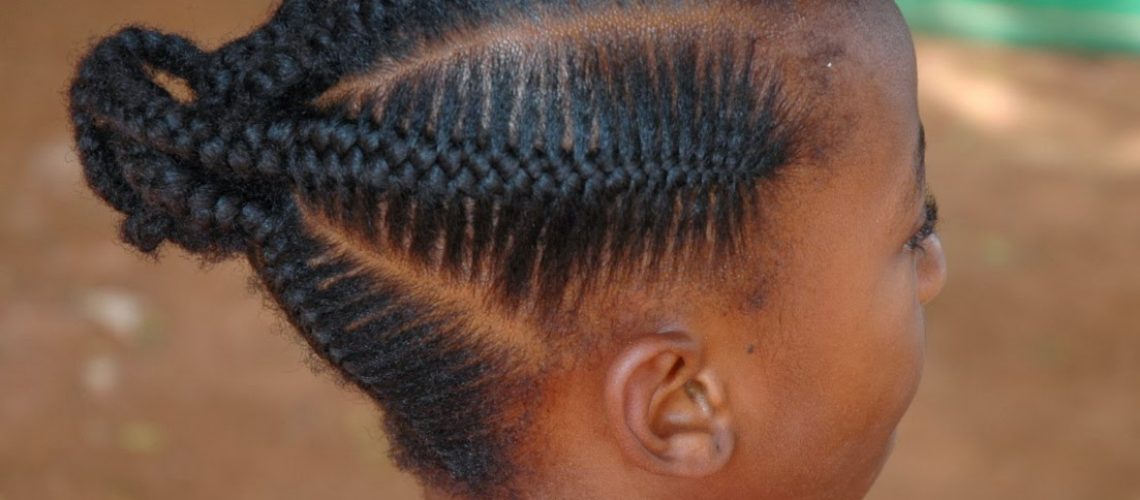 Alopecia de tração: o que é e como evitar