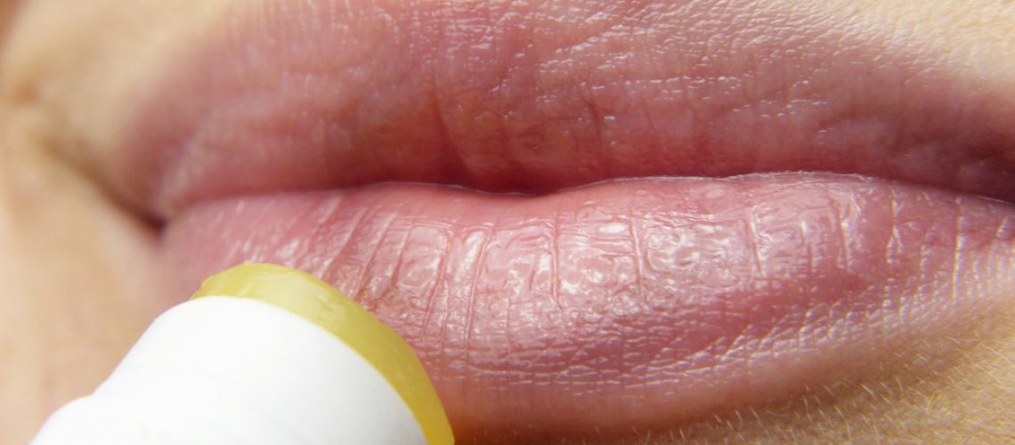 herpes como prevenir